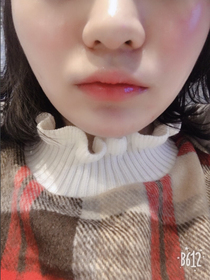 수비니ts's Lip Filler review