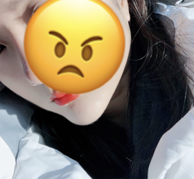 민자니's Botox, Chin Filler review