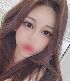 투리구슬's Non-Incisional Double Eyelid (Revision), Lower Canthoplasty review