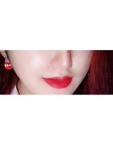 알록달록우유's Filler, Botox, Contouring Injection review