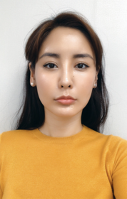나모나's Full-Face Fat Grafting review