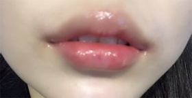 lol's Lips review