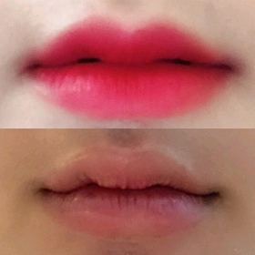sodh's Lip Filler review