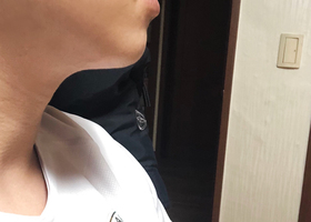 ㄱ강님의 슈링크 후기