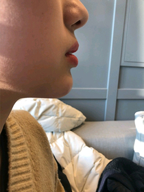 fdksk's Chin Filler review