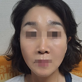 리얼리겅's Facelift review