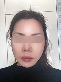 보라색남색's Facelift review