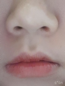 ds0405's Botox review