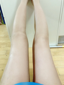 미양's Liposuction review