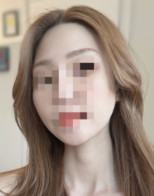라뷰v2's Facial Contouring review