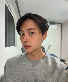 븽븽's Incisional Ptosis Correction, Nose, Three-Part Contouring review