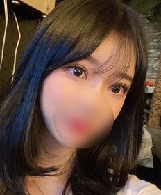 뽀모도로's Incisional Double Eyelid (Revision) review
