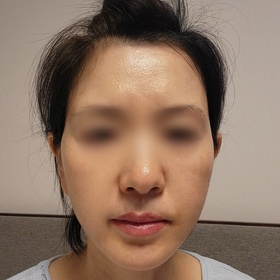 사랑하는나의's Facelift review