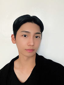 호우's Cheekbones, Incisional, Under-Eye Fat Repositioning review