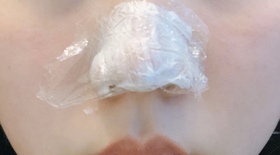 프뤼리's Botox, Nasal Tip review