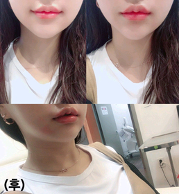 ghyghy's Lip Filler review