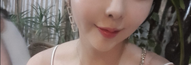 꾸꾸루루's Lip Filler, Thread Lift review