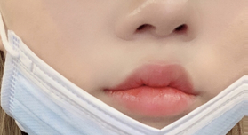 깜띅이꾸쿠's Lip Filler review