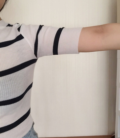 가루's Liposuction review