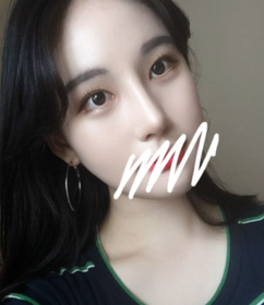 예감이좋아's Nose, Eyes, Forehead Lift review