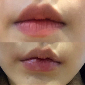 찌닝니니's Lips review