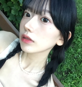 이슬's Non-Incisional Ptosis Correction review