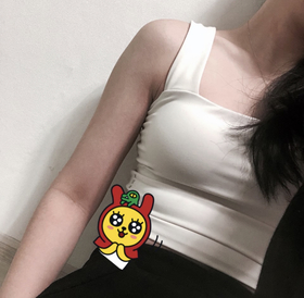 힘드로's Arm Liposuction review