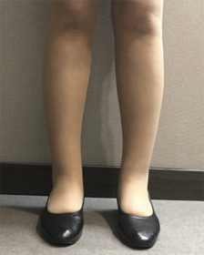 별처럼날아라's Calves review