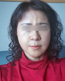 오리는못날지롱's Facelift review