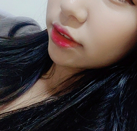 루리리루's Double Chin Liposuction review