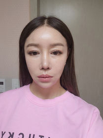 미끈미끈's Facelift review