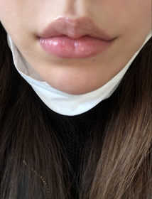 vvkim's Filler review