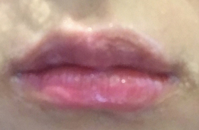 쌍수성공쓰's Lip Filler review