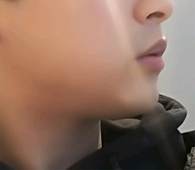 꺄륵릌님의 슈링크,윤곽톡스 후기