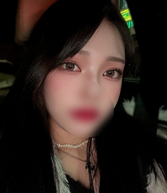 코코아's Incisional Double Eyelid, Epicanthoplasty review