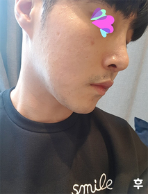 용이지롱님의 슈링크 후기