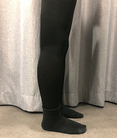 별처럼날아라's Abdomen, Calves, Liposuction review