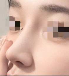 찌룽해's Nose review