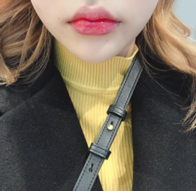 앙홈런볼's Lip Filler, Botox review