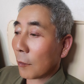 양봉아저씨's Facelift review