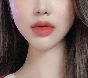 세요링's Alar Botox review
