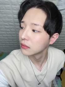 혁쓰's Incisional Ptosis Correction, Epicanthoplasty, Nose review