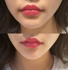 아머미's Filler review