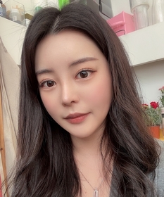 초코초's Non-Incisional Double Eyelid (Revision) review