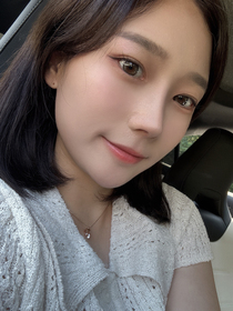 쨈이님의 콧대 코끝 절골 매부리 긴코 복코 후기