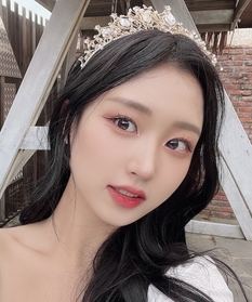 눈꽃빙수's Non-Incisional Ptosis Correction, Lateral Canthoplasty review