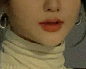 다니륭's Contouring Injection, Jaw Botox review