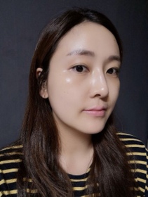 현뽀쭈's Shurink, Contouring Botox review