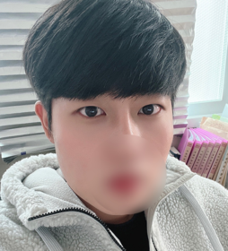 유강's Incisional Ptosis Correction review