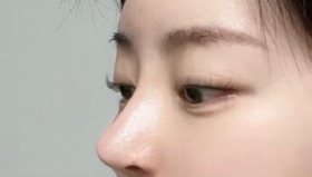 미유뮤's Nose review